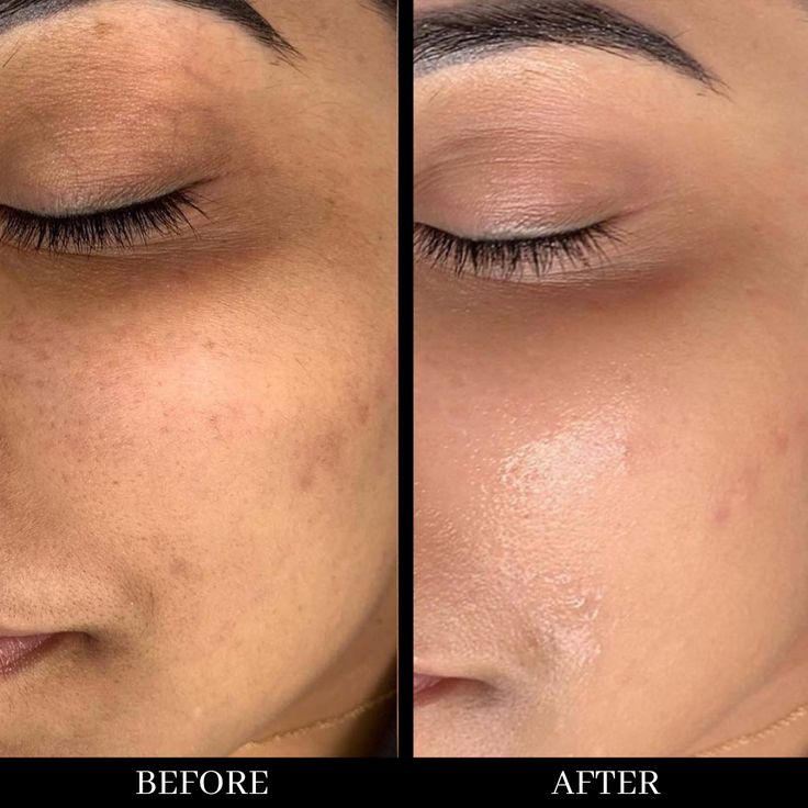 AgeLiss Collagen Anti-Wrinkle Multi Balm Stick