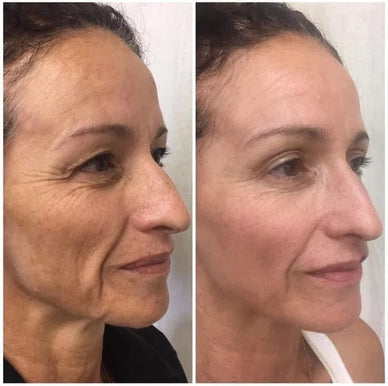 Reveal Your Skin's Youthful Radiance Today!